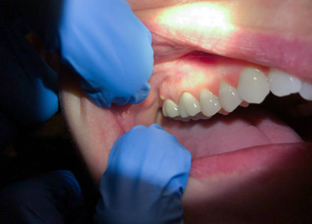 Best Emergency Dentist for Special Needs Patients in Tennessee Ridge, TN