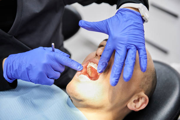 Best Emergency Dentist for Lost Fillings or Crowns in Tennessee Ridge, TN